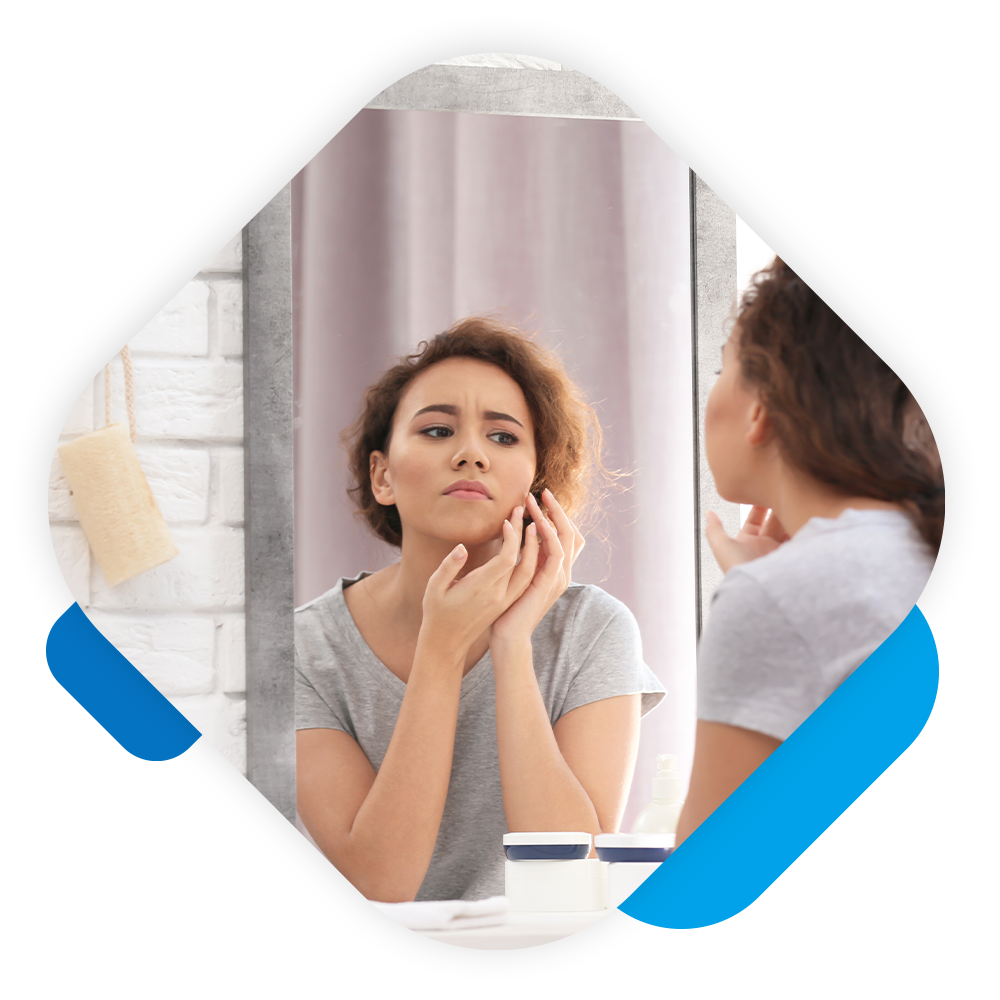 Acne Treatment PB - img 1