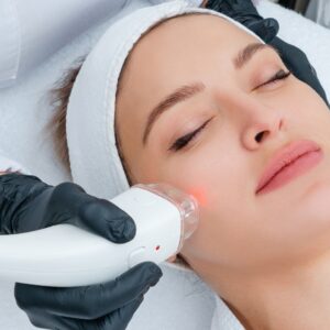 laser treatment face