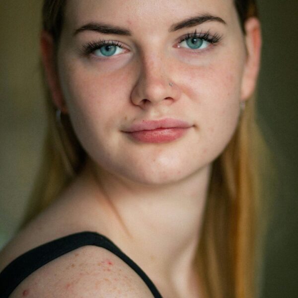 woman with freckles on shoulders
