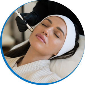 Microdermabrasion