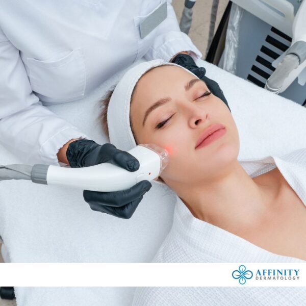 skin laser treatment